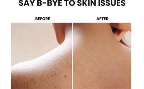 HOMENITY® - Magic Secret Moroccan Hammam Exfoliating Bath Scrub Glove ...