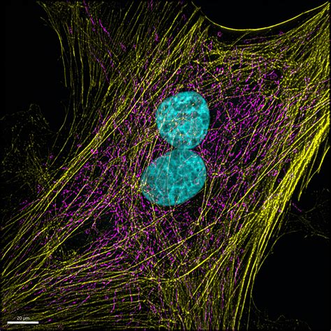Imaris 9.7 - 3D/4D Image Visualization & Analysis with Deconvolution | Microscopy Software ...