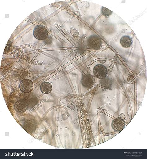 Rhizopus Under Microscope