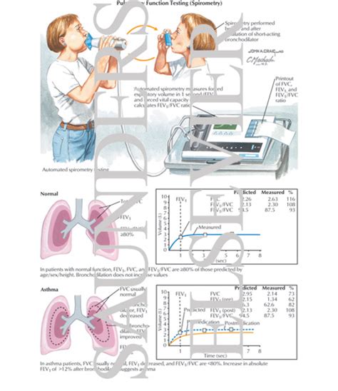 Image result for Pulmonary Function Testing