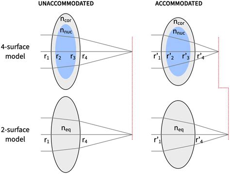 Intracapsular accommodation mechanism in terms of lens curvature ...