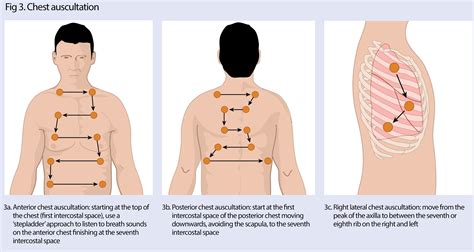 How to carry out a respiratory assessment in advanced practice ...