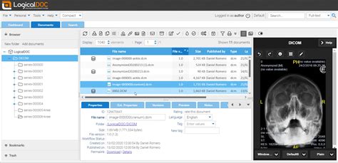 DICOM Query Retrieve Tool 的图像结果
