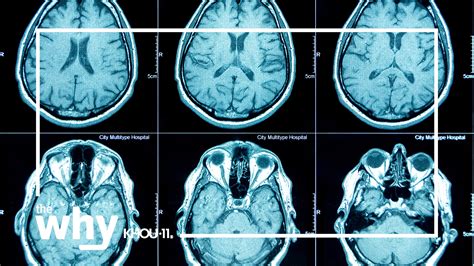 Why social media use is linked to brain changes in teens | khou.com