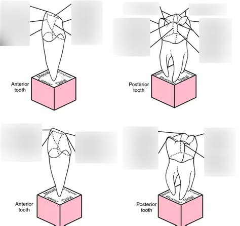 Line Angle Teeth 的图像结果
