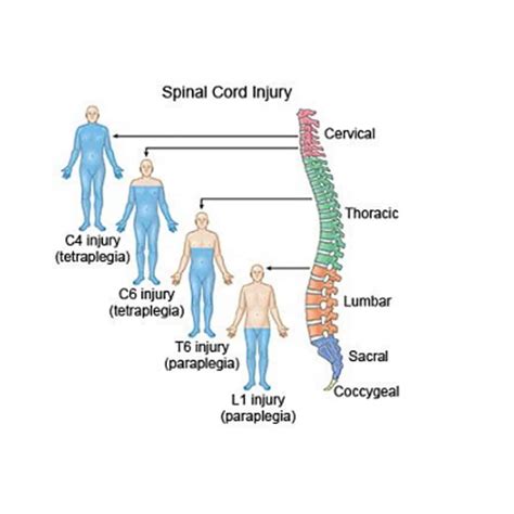 Spinal Cord Injury Levels And Function Chart