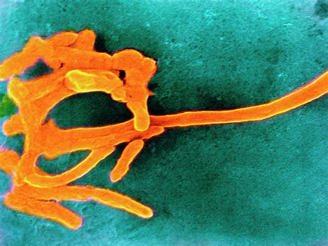 Image result for Urease Enzyme Attoms