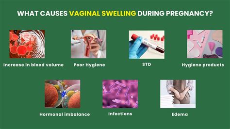 How to Manage Vaginal Swelling in Pregnancy