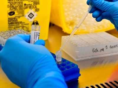 'New simplified Covid-19 antibody test developed' - Times of India