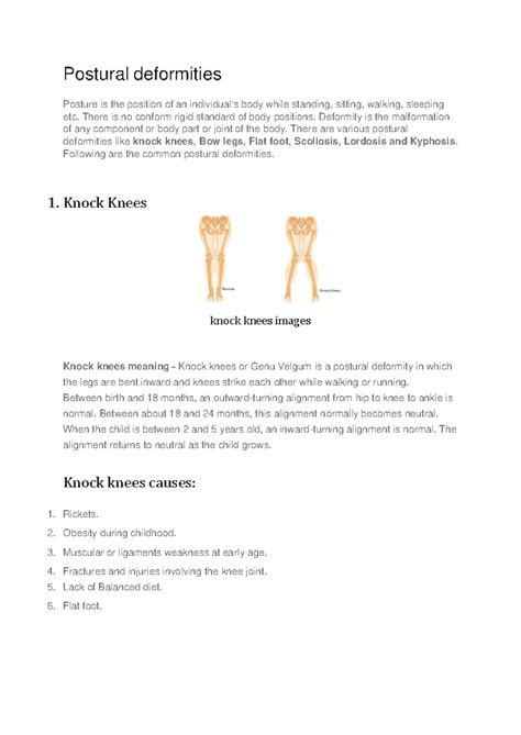 Postural Deformities: Understanding and Remedies in Physical Education ...