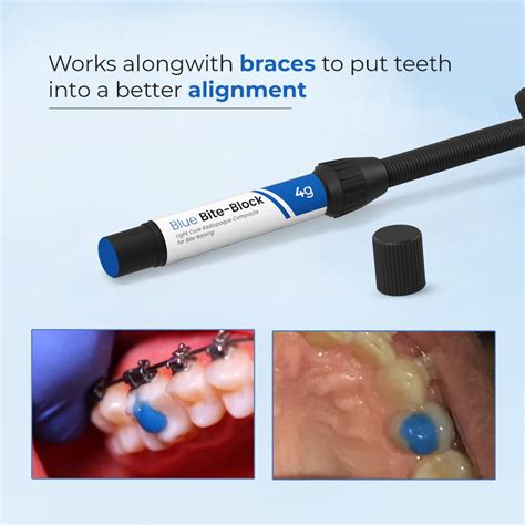 Waldent Blue Bite-Block – Waldent.com