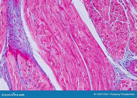 Image result for Cardiac Muscle Tissue Cells
