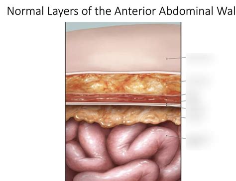normal layers of the anterior abdominal walls Diagram | Quizlet