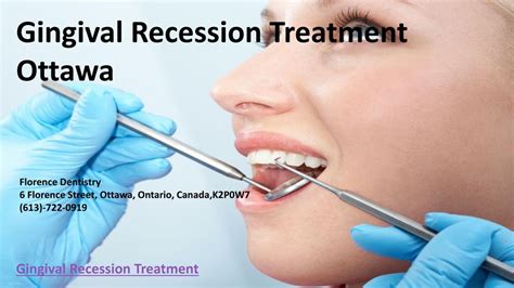 PPT - Gingival Recession Treatment Ottawa PowerPoint Presentation, free download - ID:7340121