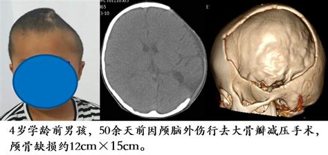 新生儿颅骨解剖颅骨缝合线和插画图片素材_ID:408593510-Veer图库