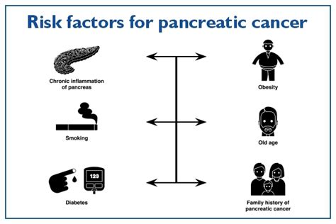Pancreatic cancer: Symptoms, Causes, Risks & Diagnosis