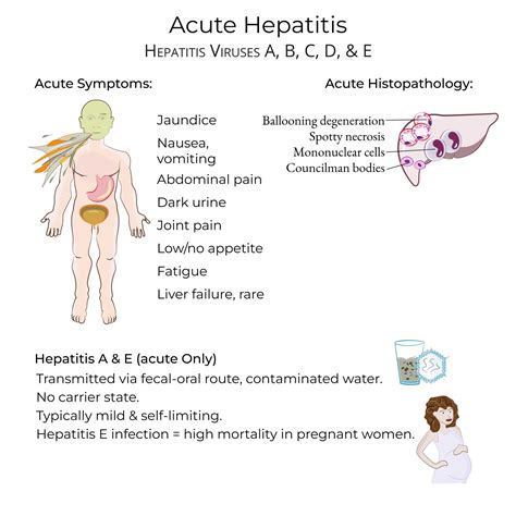 Clinical Pathology Glossary: Acute Hepatitis | ditki medical & biological sciences
