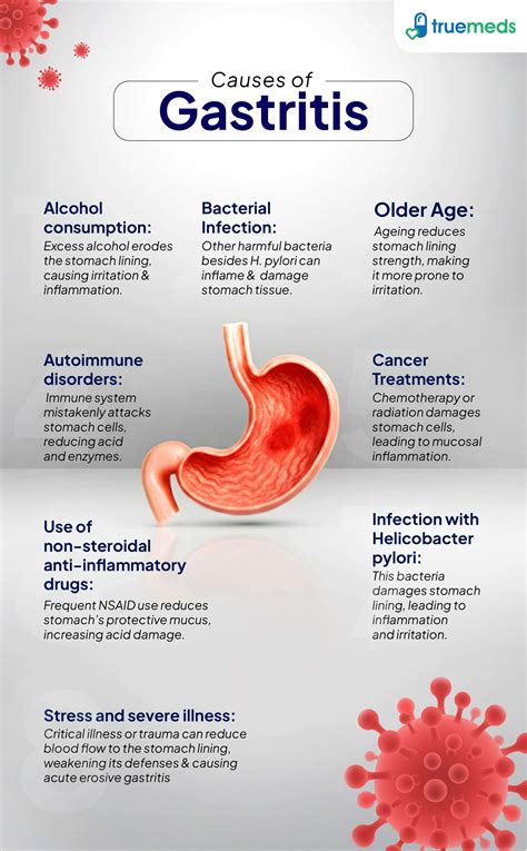 Gastritis: Causes, Symptoms, Treatment & Prevention