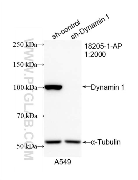 Dynamin 1 antibody (18205-1-AP) | Proteintech