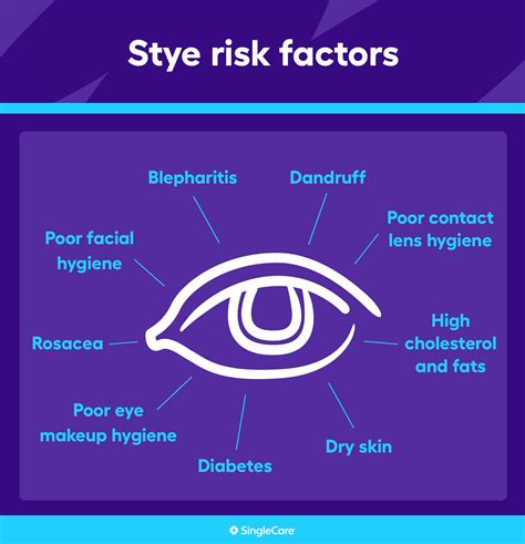 What causes a stye? Diagnosis, prevention, and treatment