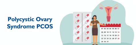 What is Polycystic Ovary Syndrome (PCOS)?