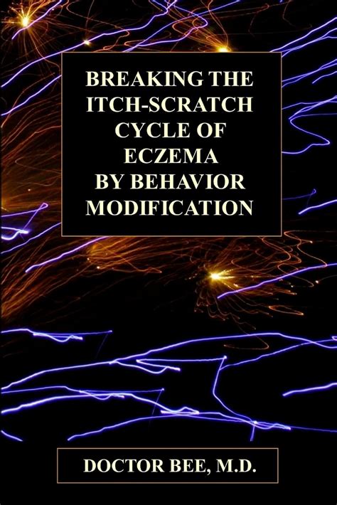 Buy Breaking the Itch-Scratch Cycle of Eczema by Behavior Modification ...