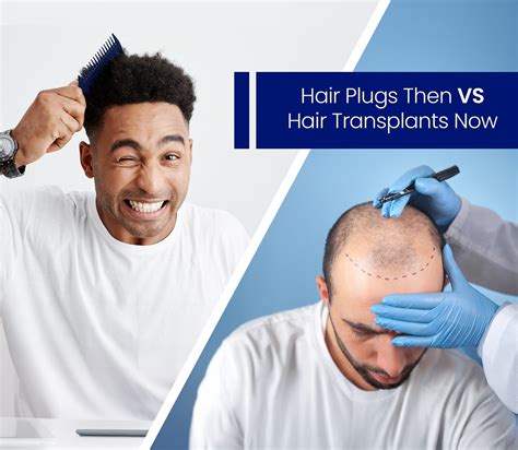 How has the evolution been from hair plugs to hair transplants?
