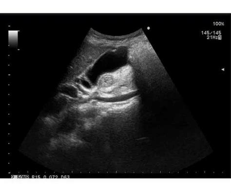 Ultrasound Machine - Cath Lab Machine Trader - Wholesaler / Distributor ...