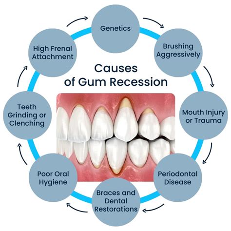 8 Causes of Gum Recession | Broadway Family and Cosmetic Dentistry