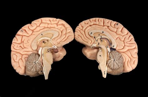 Image result for Split Brain Part One