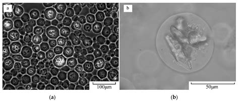 Preparation and Evaluation of Microcapsules Encapsulating Royal Jelly ...