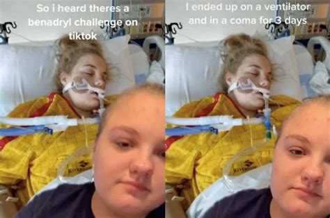 The FDA has issued a warning against the TikTok ‘Benadryl challenge ...