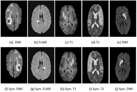 J. Imaging | Special Issue : Advances in Medical Imaging and Machine ...