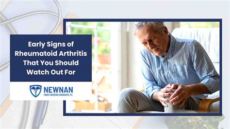 Early Signs Of Rheumatoid Arthritis Age at Jesse Sauers blog