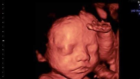 怀孕24周的胎儿具体长什么样子？迎来身体的第一个快速发育期|胎儿|怀孕|发育_新浪新闻