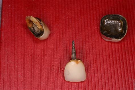 Straight from the Dentist's MouthStraight from the Dentist's Mouth, Raymond E. LaVigne DDS ...