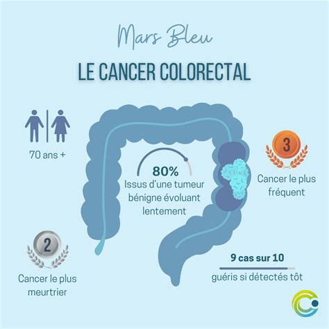 Qu'est-ce que c'est : Le cancer colorectal