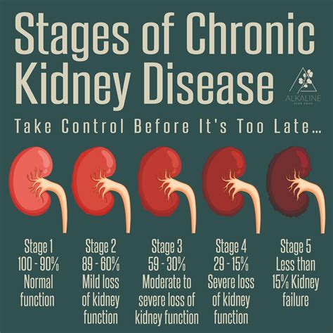 Best 13 Chronic Kidney Disease: Stages, Treatments & Nutrition Hacks ...