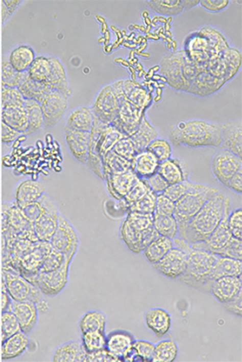 细菌和真菌的分布ppt4 人教版