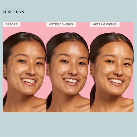 Glow Recipe Guava Vitamin C + Ferulic Dark Spot Serum 30ml – Luxe by Kan