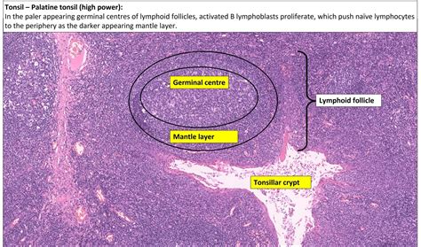 Tonsil – Normal Histology – NUS Pathweb :: NUS Pathweb