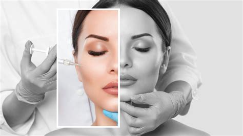 Attraktive Aussichten für die medizinische Ästhetik? - Plastische ...