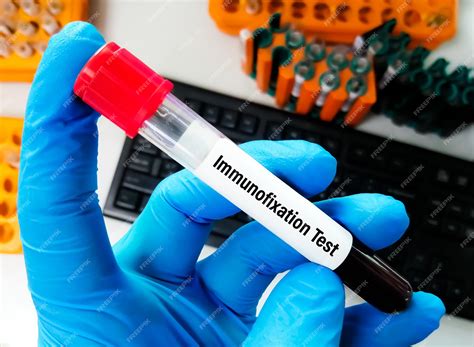Premium Photo | Immunofixation or immunoelectrophoresis test, to help diagnose or monitor ...
