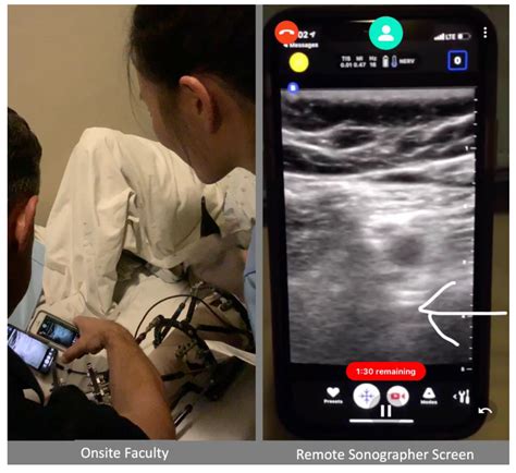 Use of a Smartphone-Based Augmented Reality Video Conference App to ...