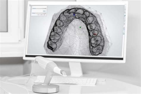 3Shape TRIOS Digital Technology – Orthodontist Chalfont Invisalign ...