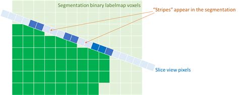 Image result for 3D Slicer Segmentation Tutorial