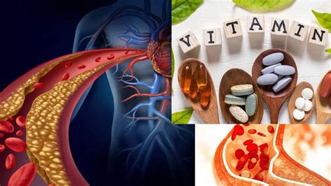 Vitamin to control Cholesterol Problem: কোন ভিটামিনের অভাবে খারাপ ...