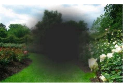 Visual Field Defects Explained 的图像结果