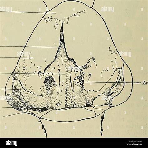 Image result for Lamina Terminalis Embryonic Development