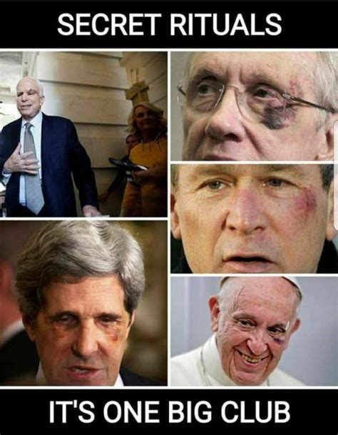 Bildergebnis für politicians and celebrities with black eyes
